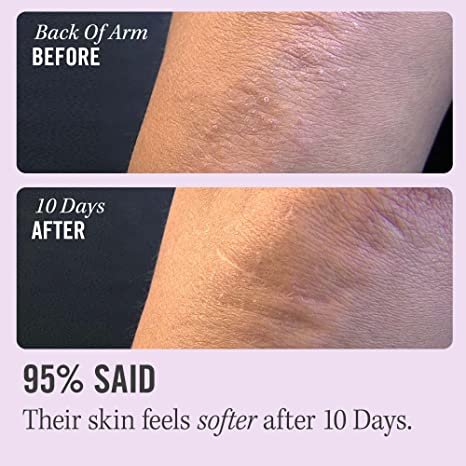 First Aid Beauty KP Bump Eraser Body Scrub Exfoliant for Keratosis Pilaris with 10% AHA 2 oz