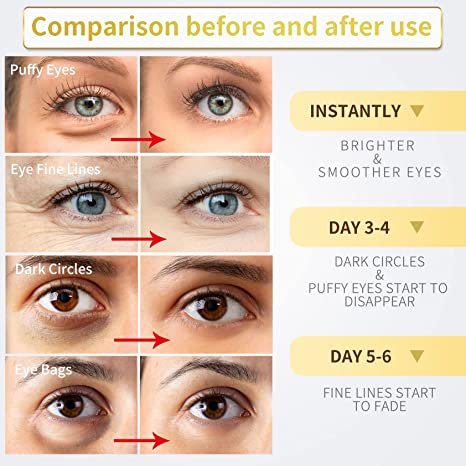 Under Eye Patches - 30 Pairs - 24K Gold Eye Mask- Puffy Eyes & Dark Circles Treatments, Eye Skin Care Pads With Collagen